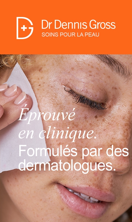 Dr. Dennis Gross Skincare. Éprouvé en clinique. Formulés par des dermatologues | Mannequin essuyant une lingette sur son visage