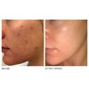 Dr. Dennis Gross Skincare Alpha Beta® Extra Strength Daily Peel Image 2