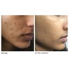 Dr. Dennis Gross Skincare Alpha Beta® Extra Strength Daily Peel Image 3