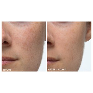 Dr. Dennis Gross Skincare Alpha Beta® Extra Strength Daily Peel Image 4