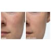Dr. Dennis Gross Skincare Alpha Beta® Extra Strength Daily Peel Image 4