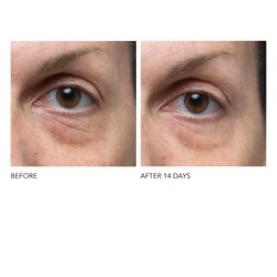 ddg retinol eye serum