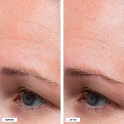 perricone hyaluronic