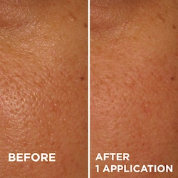 dr brandt dermabrasion