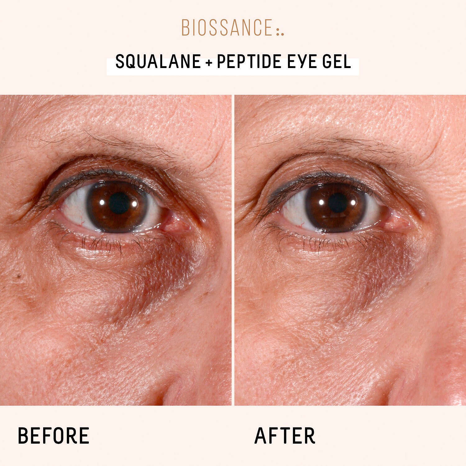 Roc Retinol Correxion Makeupalley Mugeek Vidalondon