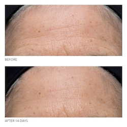dr dennis gross c  collagen moisturizer