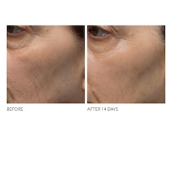 dr dennis gross c collagen cream