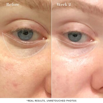Wide Awake Brightening Eye Cream With Avocado Saturday Skin Sephora