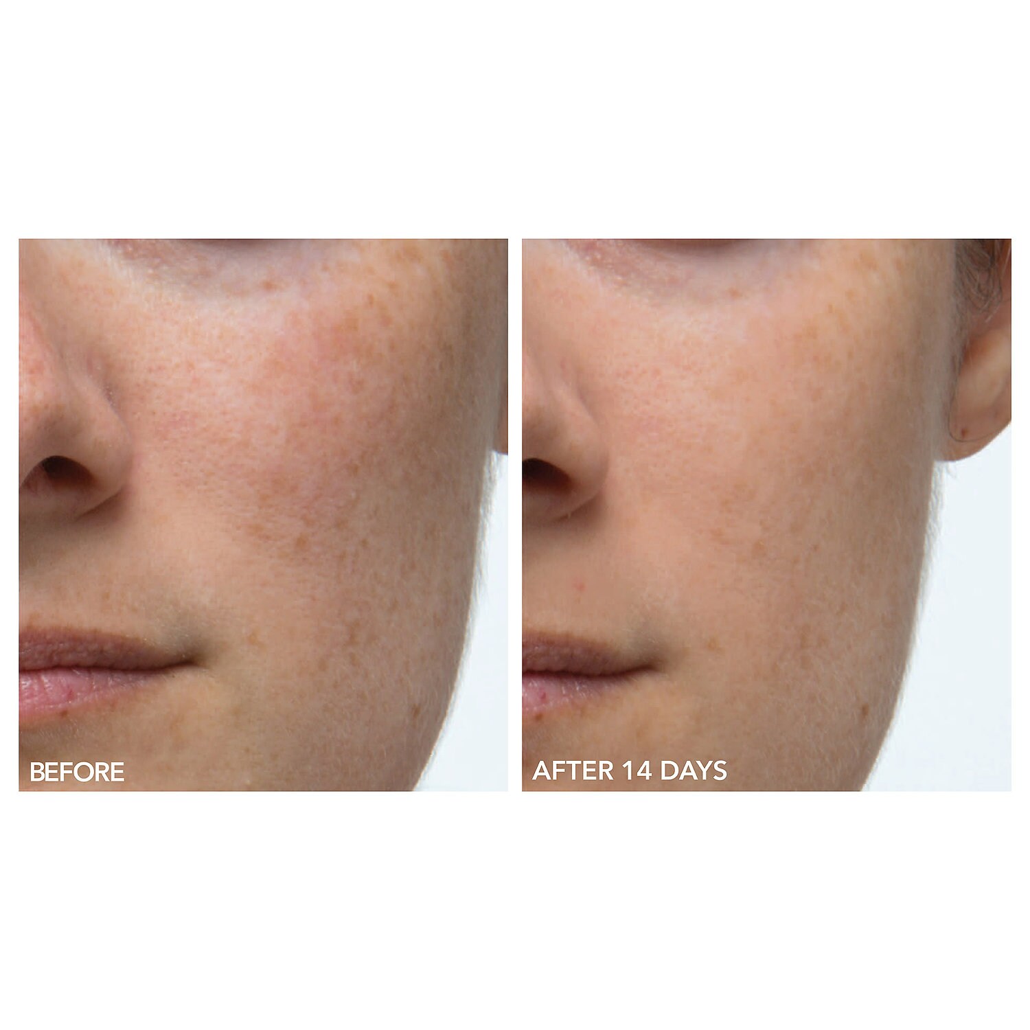 sephora dr gross peel pads