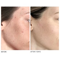 dr dennis gross skin heroes
