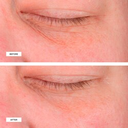 perricone md cold plasma plus eye cream