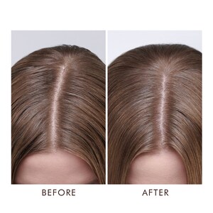 Moroccanoil Dry Scalp Treatment Image 2