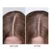 Moroccanoil Dry Scalp Treatment Image 2