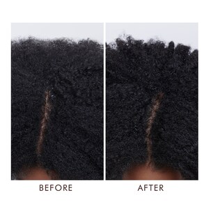 Moroccanoil Dry Scalp Treatment Image 3