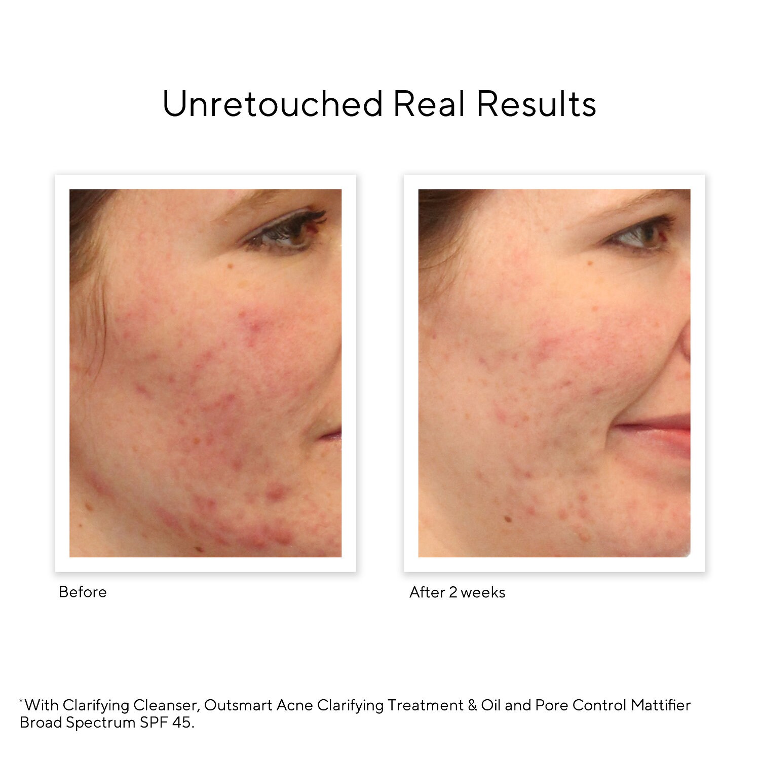 murad blemish control clarifying body spray