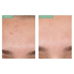 caudalie oil free moisturizer