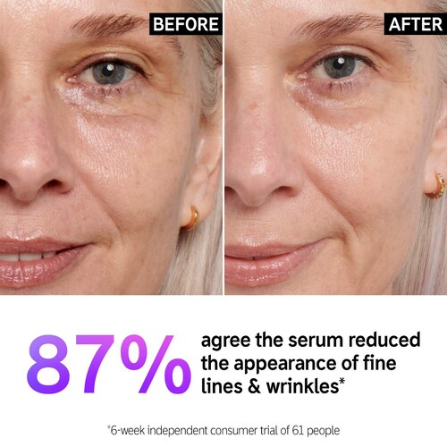 The INKEY List Retinol Fine Lines and Wrinkles Serum in 1 oz/ 30 mL Image 3