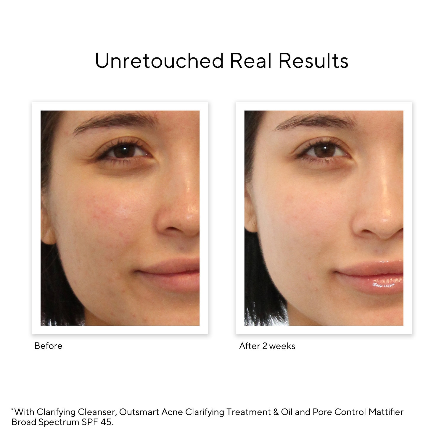 murad mattifying lotion