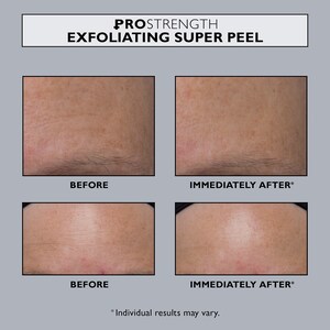 Pro Strength Exfoliating Super Peel Peter Thomas Roth Sephora