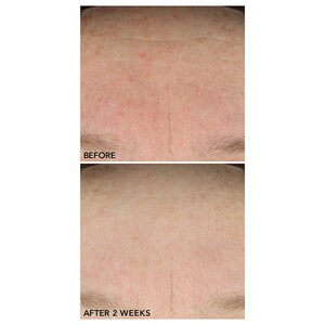 Dr. Dennis Gross Skincare B3Adaptive Superfoods Stress Rescue Super Serum with Niacinamide Image 2
