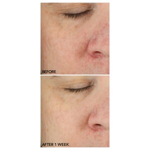 Dr. Dennis Gross Skincare Stress Rescue Super Serum with Niacinamide Image 3