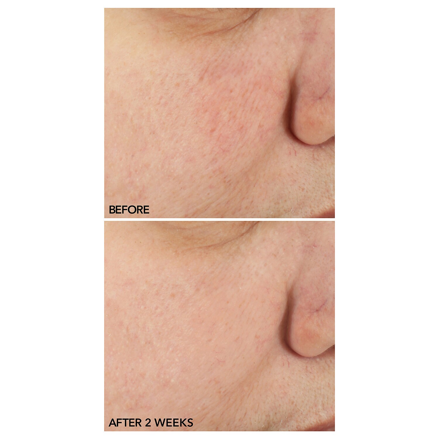 dr dennis gross face cream