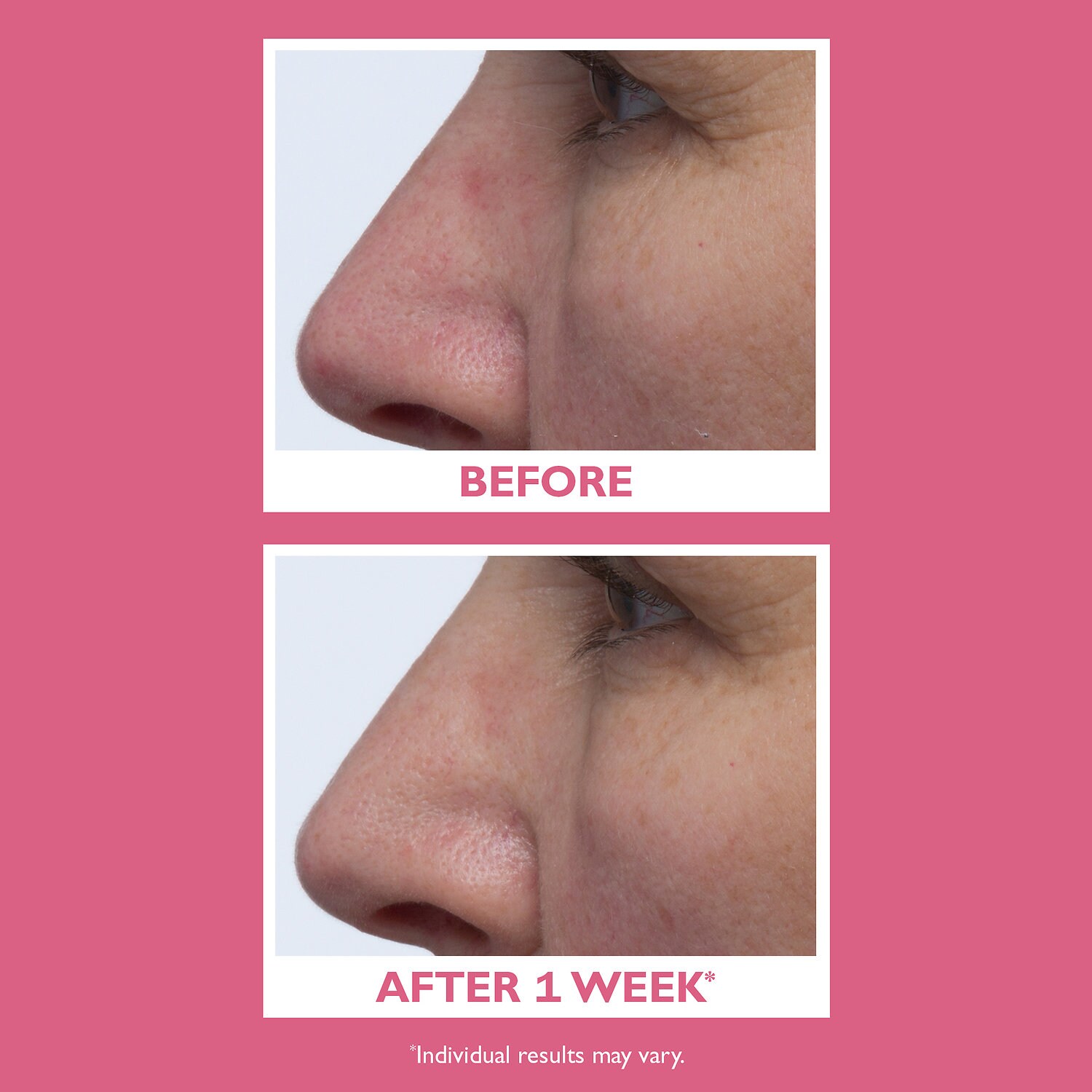 peter thomas roth vital e microbiome