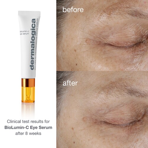 Dermalogica Sérum pour les yeux à la vitamine C Biolumin-C in 0.50/15 Image 5