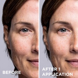 dr brandt microdermabrasion 2 oz