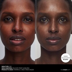 vitamin bce moisturizer