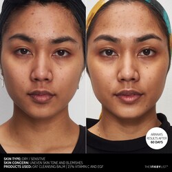 vitamin c egf serum