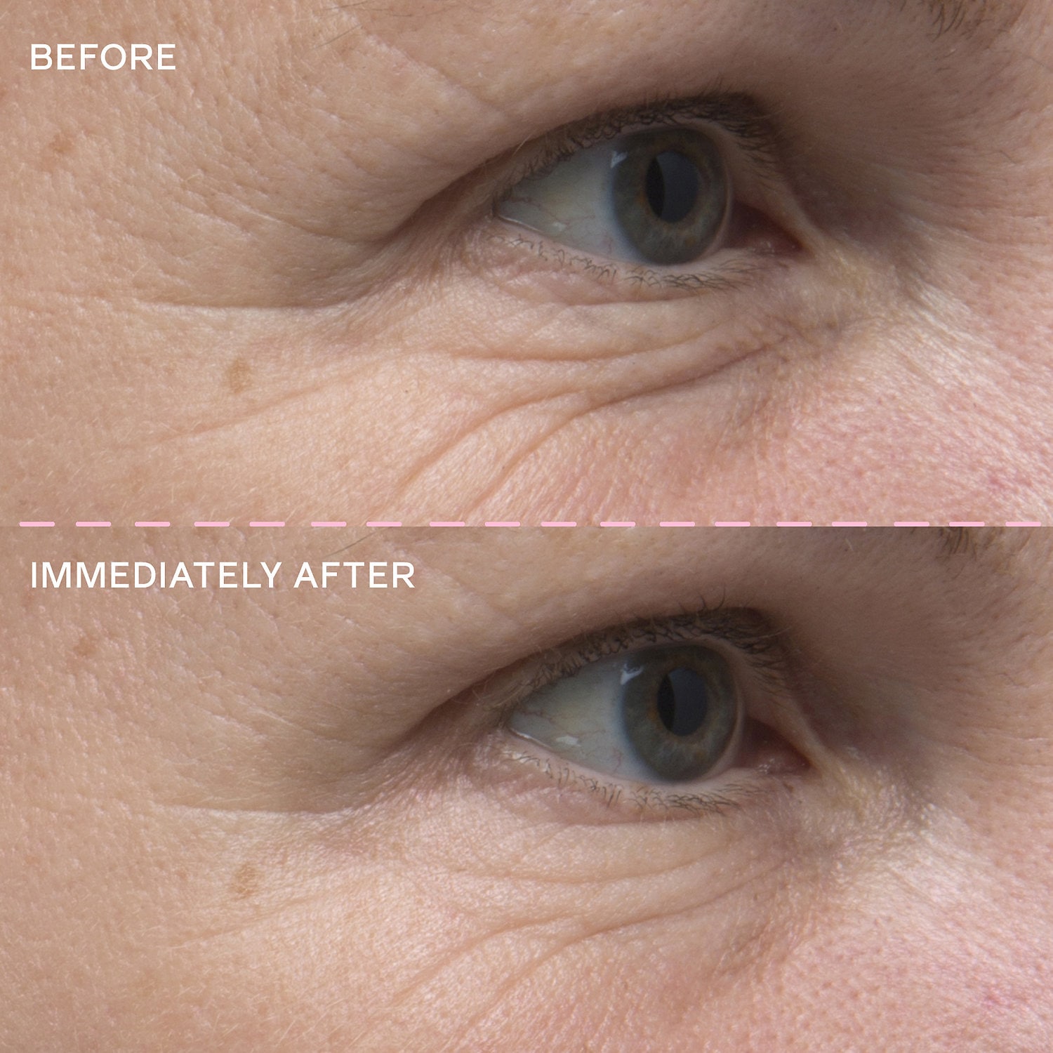 alpyn beauty eye balm