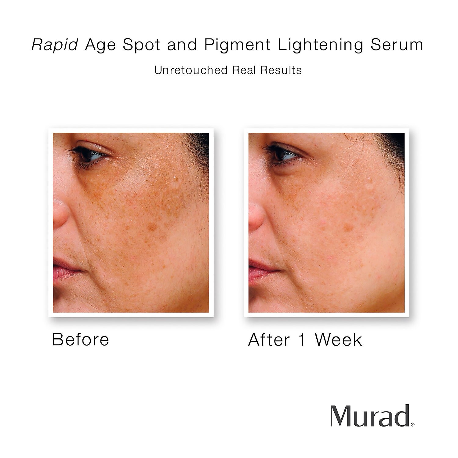 murad dark spot remover