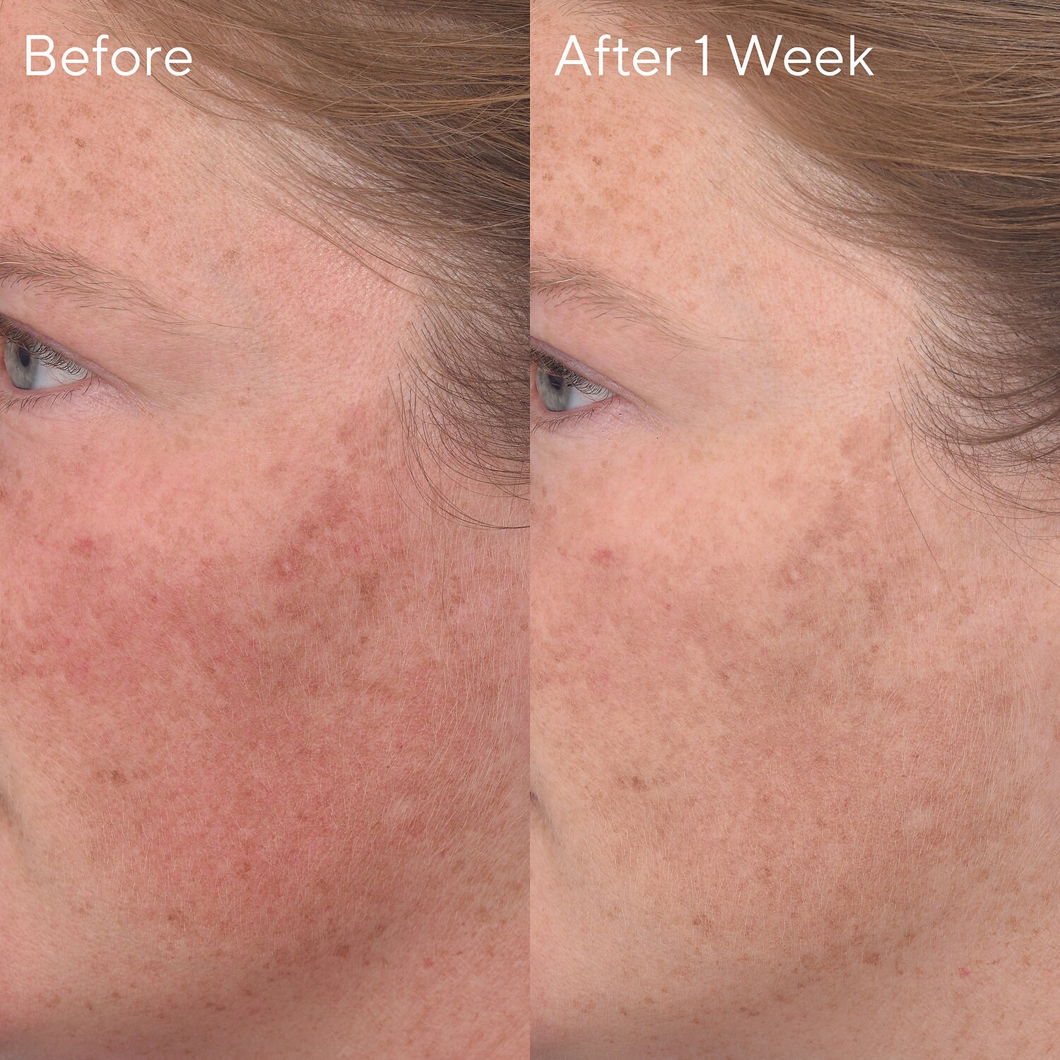 murad dark spot remover