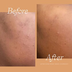 sephora hemp night face serum