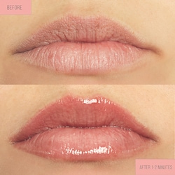 Platinum Lip Plump SPF 30 - Dr. Lara 