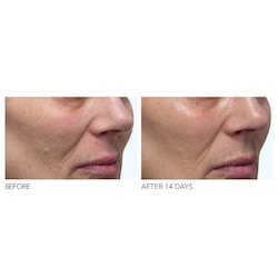 dennis gross moisturizer