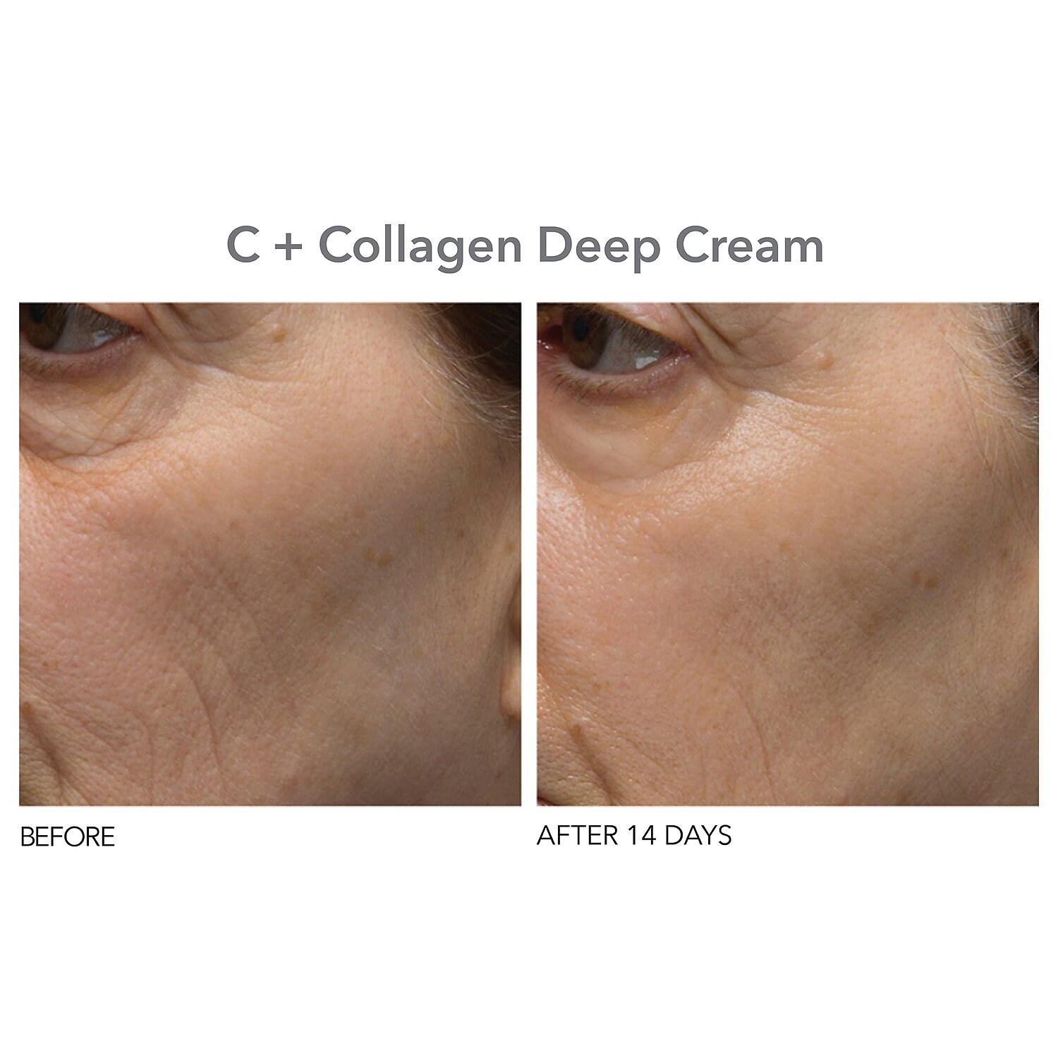 dr dennis gross peel glow be merry