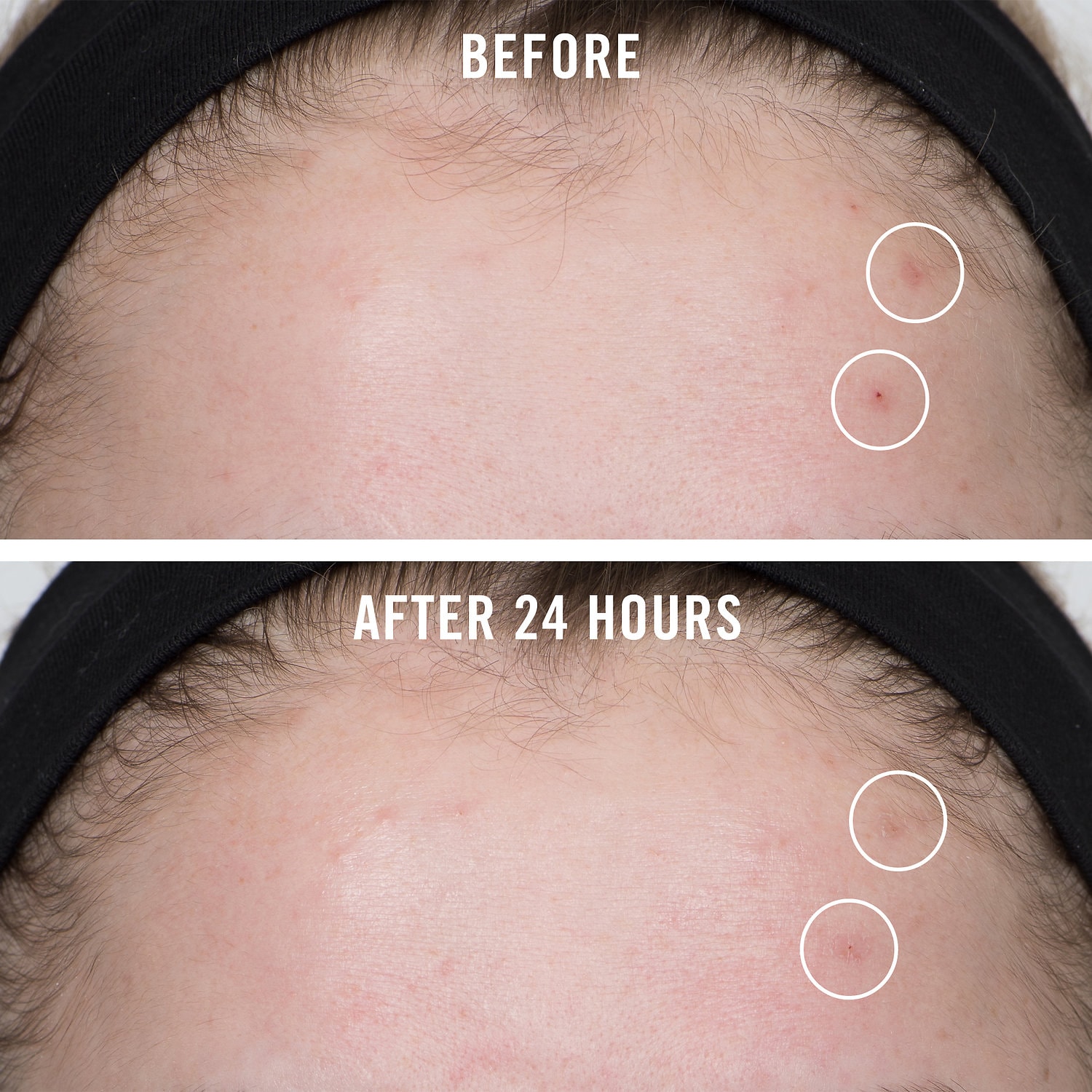 fab pharma white clay acne