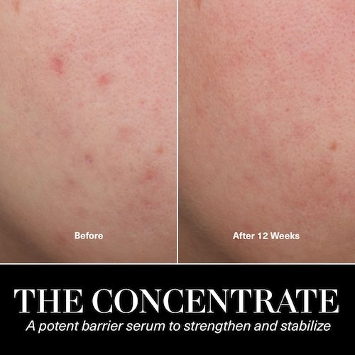 The Concentrate Serum