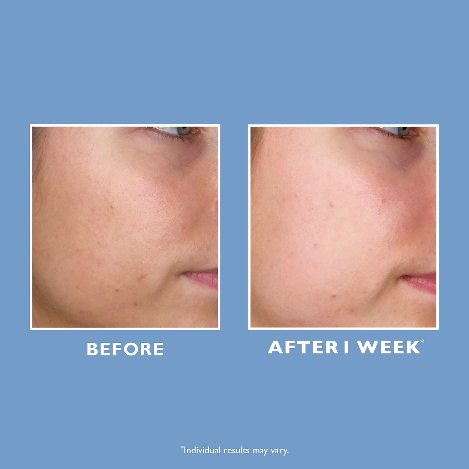 peter thomas roth 10 pha exfoliating clarifying liquid