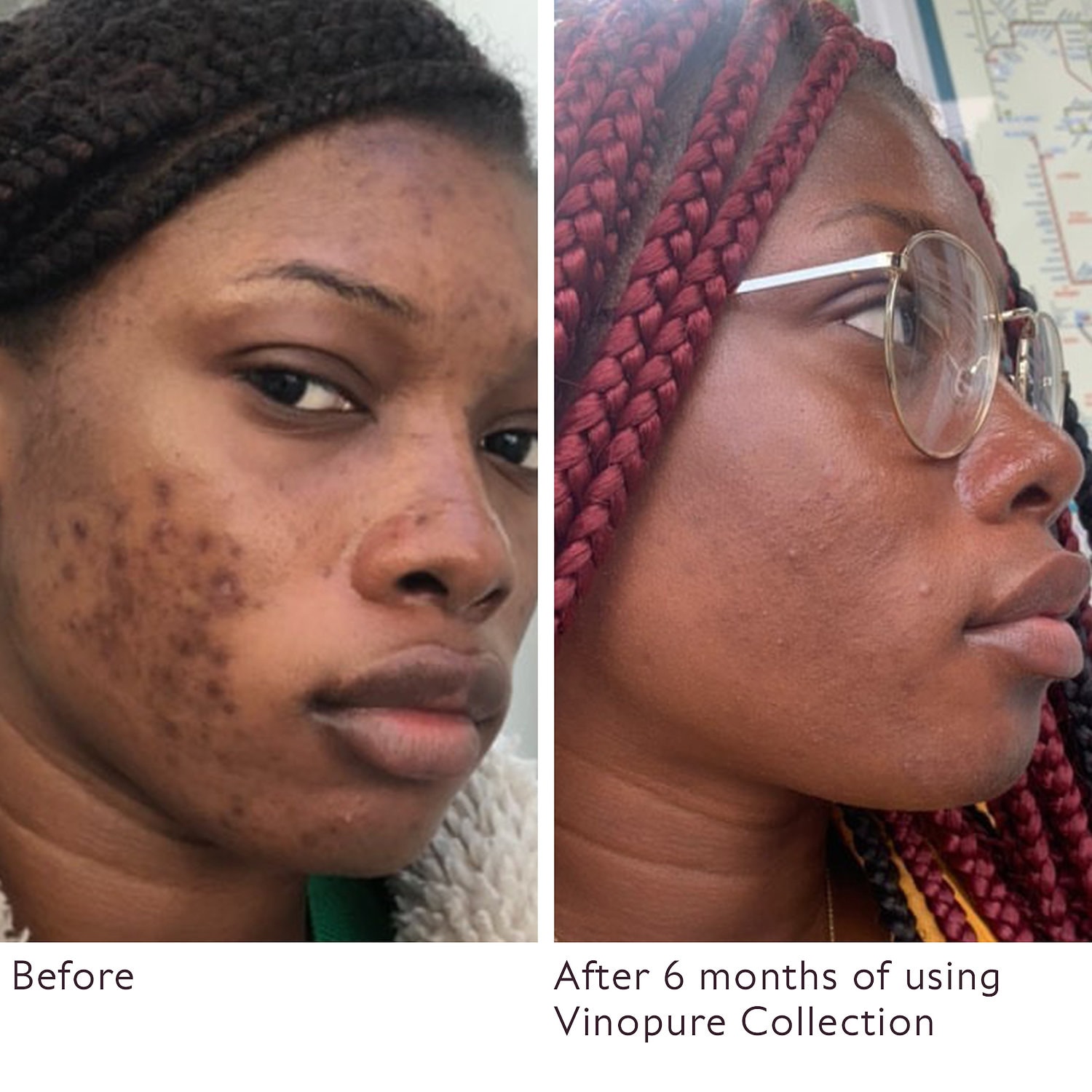 sephora caudalie vinopure