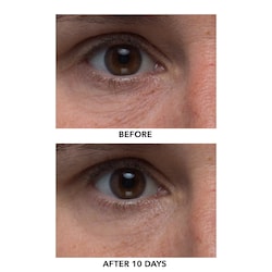 algenist complete renewal eye balm