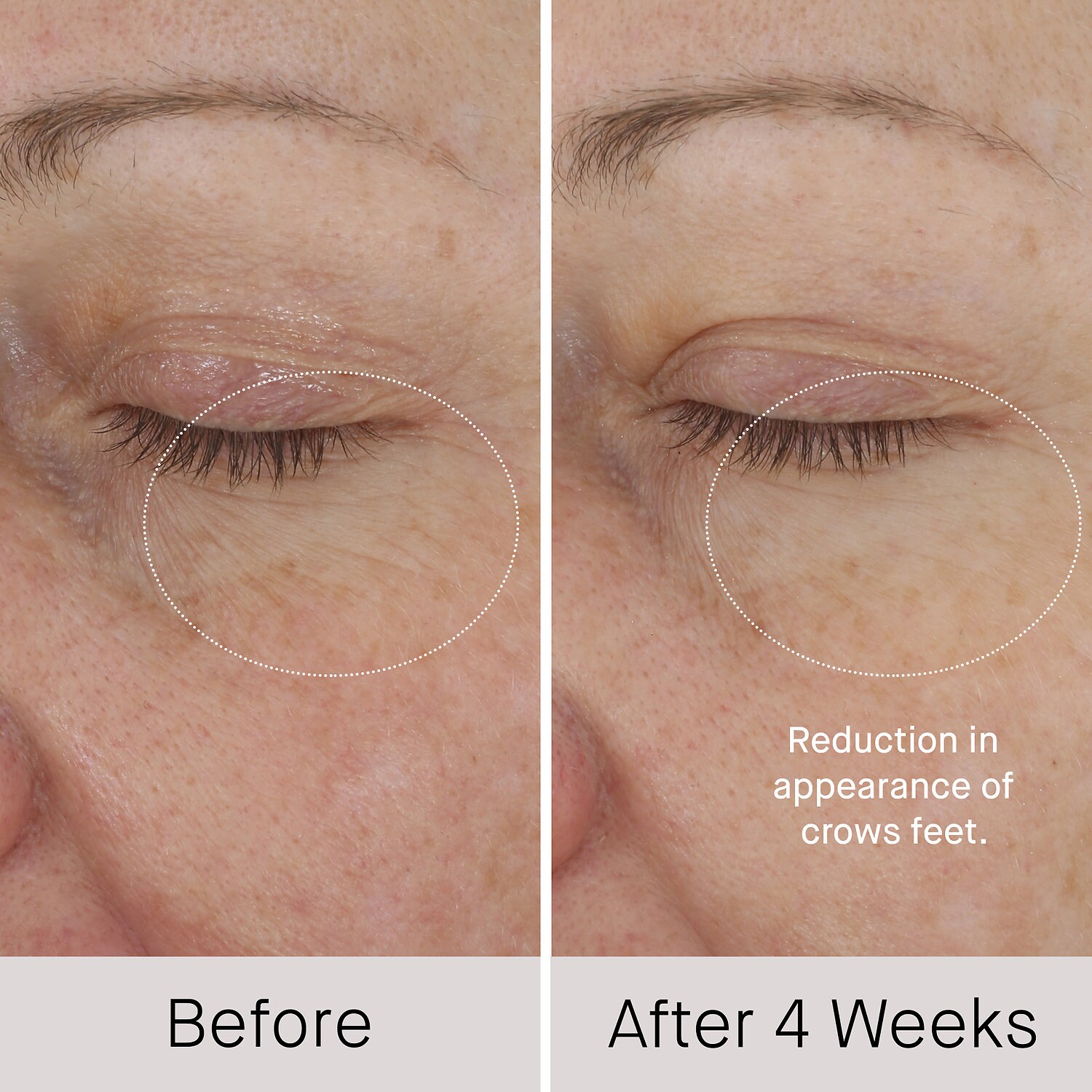 shani darden skin care intensive eye renewal cream with firming peptides