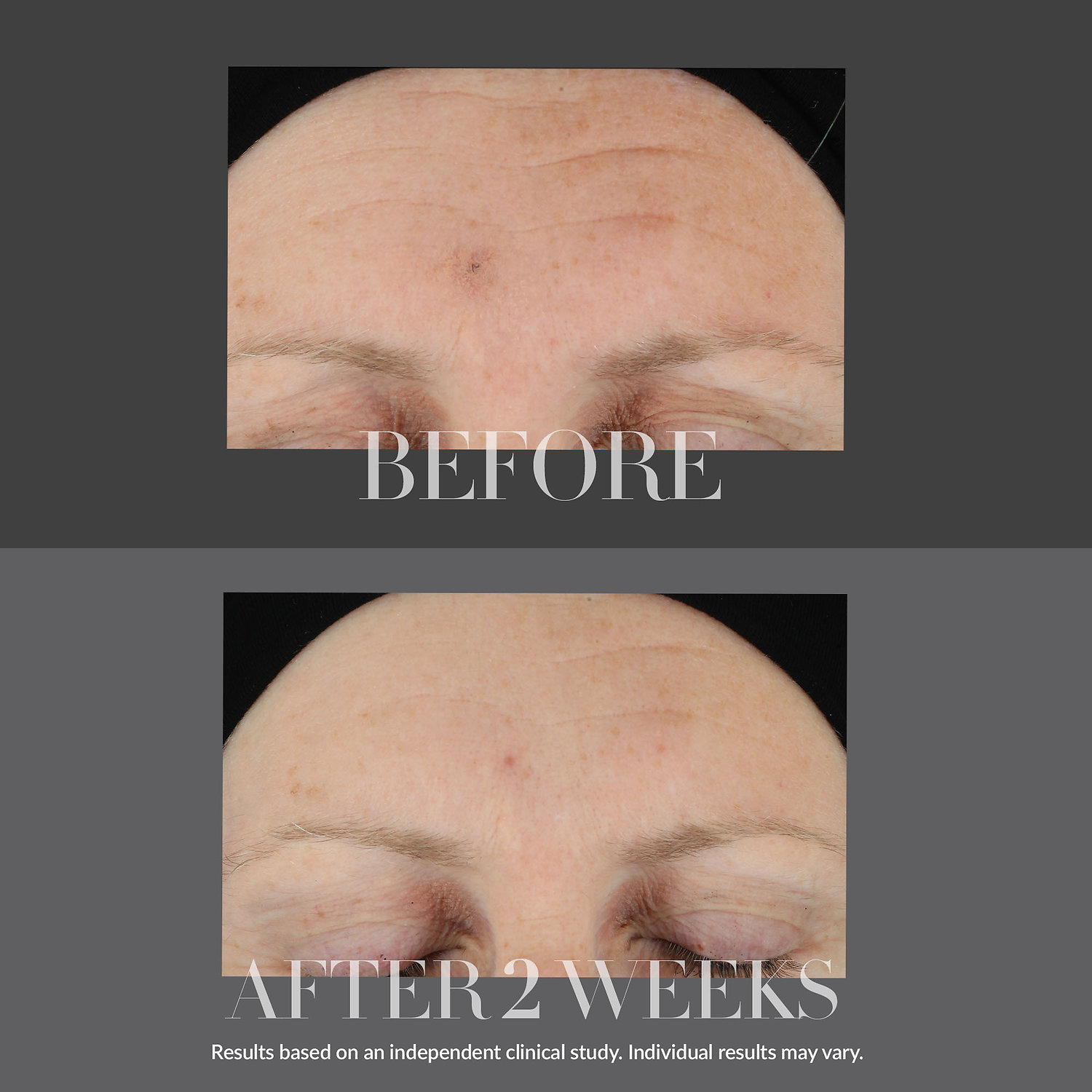 Укрепляющая сыворотка Kate Somerville KateCeuticals с трипептидом и гиалуроновой кислотой — фото 2