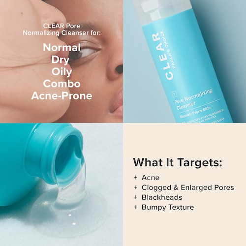 Paula's Choice CLEAR Pore Normalizing Acne Cleanser