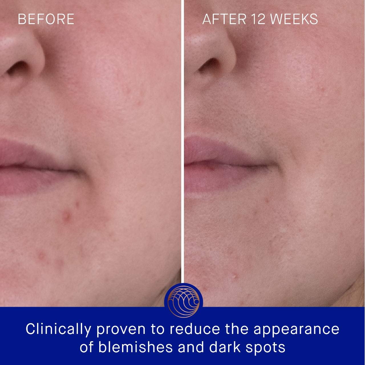 Augustinus Bader The Rich Cream with TFC8® Face Moisturizer Hamilton