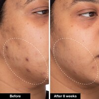 Green Machine Vitamin C Dark Spot & Hyperpigmentation Serum