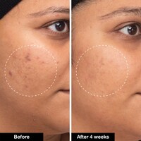 Green Machine Vitamin C Dark Spot & Hyperpigmentation Serum