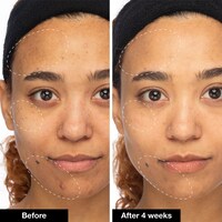 Green Machine Vitamin C Dark Spot & Hyperpigmentation Serum